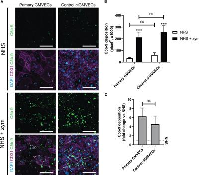 Modeling complement activation on human glomerular microvascular endothelial cells